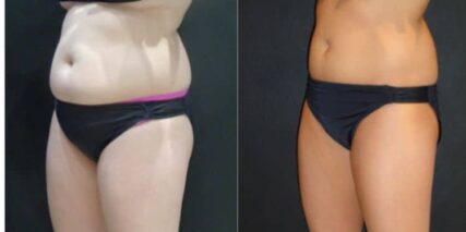 xr:d:DAFT5NNLQbs:5,j:43179482148,t:22120512