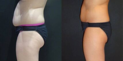 xr:d:DAFT5NNLQbs:3,j:43179158780,t:22120512