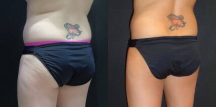 xr:d:DAFT5NNLQbs:4,j:43179408413,t:22120512