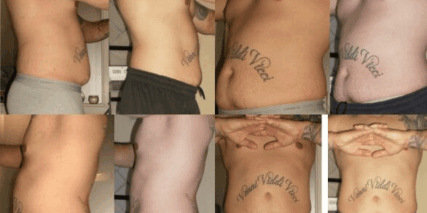 male ultraslim before and after pic